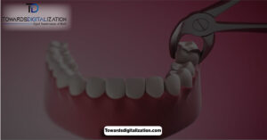 How bad is wisdom teeth removal without anesthesia​